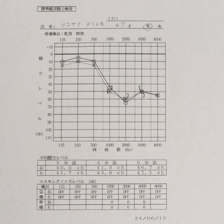 難聴改善チャレンジ：聴力検査